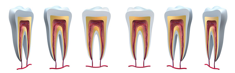 Root Canal Bismarck ND | Root Canal Therapy Garrison ND