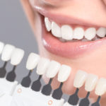 Teeth Whitening Bismarck ND