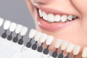 Teeth Whitening Bismarck ND