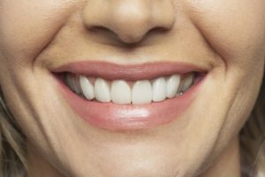 Dental Implants North Dakota